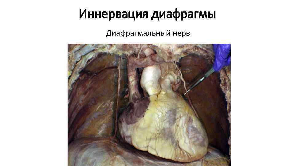 Иннервация диафрагмы Диафрагмальный нерв 