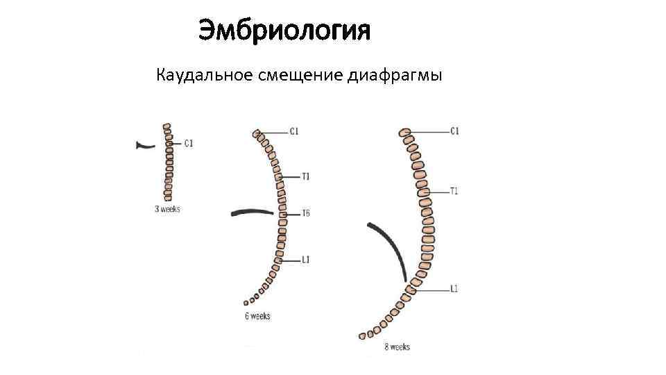 Эмбриология Каудальное смещение диафрагмы 