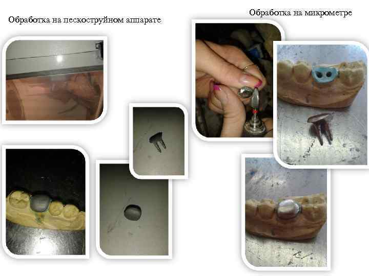 Обработка на пескоструйном аппарате Обработка на микрометре 