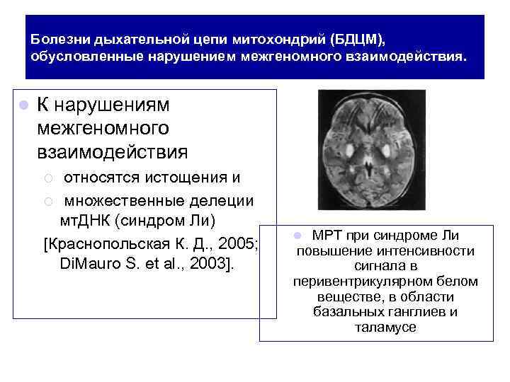 Болезни дыхательной цепи митохондрий (БДЦМ), обусловленные нарушением межгеномного взаимодействия. l К нарушениям межгеномного взаимодействия