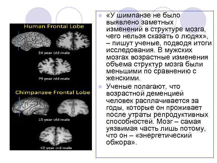  «У шимпанзе не было выявлено заметных изменений в структуре мозга, чего нельзя сказать