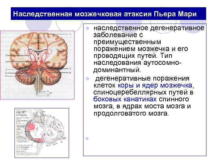 Мозжечок центры рефлексов. Мозжечковая атаксия очаг поражения. Симптомы поражения червя мозжечка неврология. Симптомы, характерные для поражения мозжечк. Спиноцеребеллярная атаксия 1 типа.