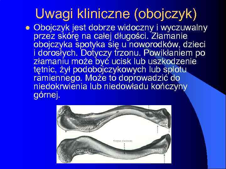 Uwagi kliniczne (obojczyk) l Obojczyk jest dobrze widoczny i wyczuwalny przez skórę na całej