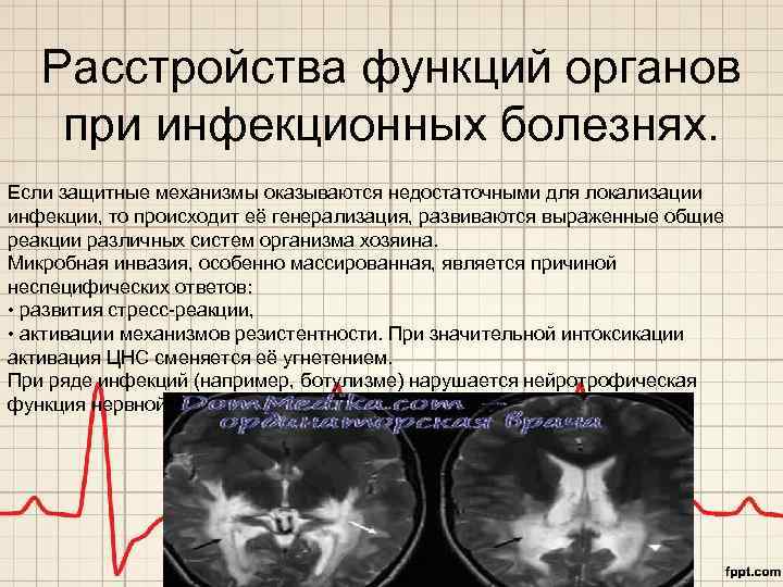 Расстройства функций органов при инфекционных болезнях. Если защитные механизмы оказываются недостаточными для локализации инфекции,