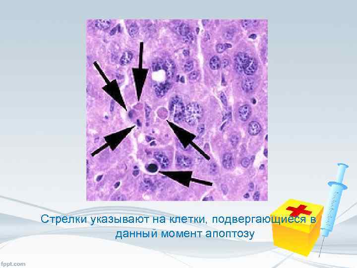 Стрелки указывают на клетки, подвергающиеся в данный момент апоптозу 