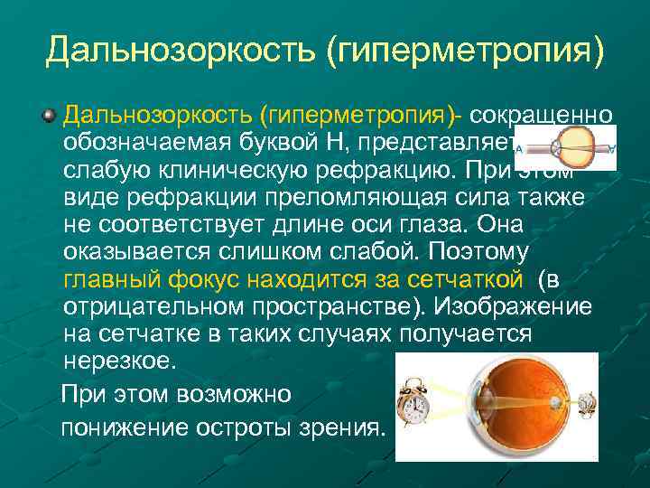 Дальнозоркость (гиперметропия) сокращенно обозначаемая буквой Н, представляет слабую клиническую рефракцию. При этом виде рефракции