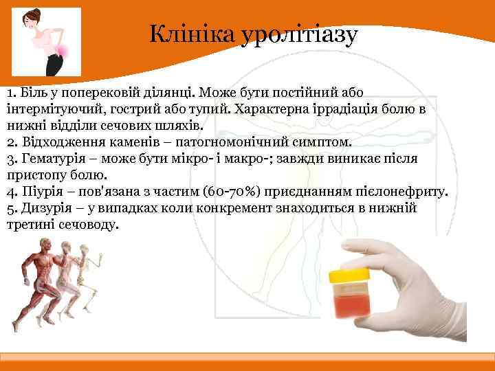 Клініка уролітіазу 1. Біль у поперековій ділянці. Може бути постійний або інтермітуючий, гострий або
