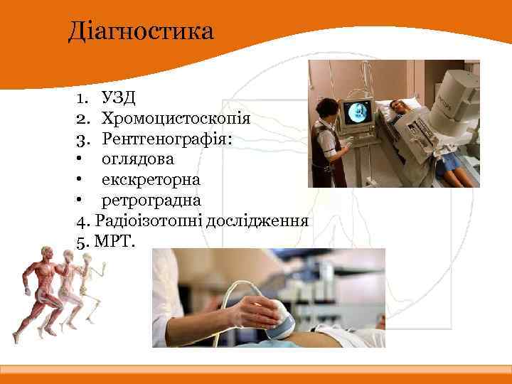 Діагностика 1. УЗД 2. Хромоцистоскопія 3. Рентгенографія: • оглядова • екскреторна • ретроградна 4.
