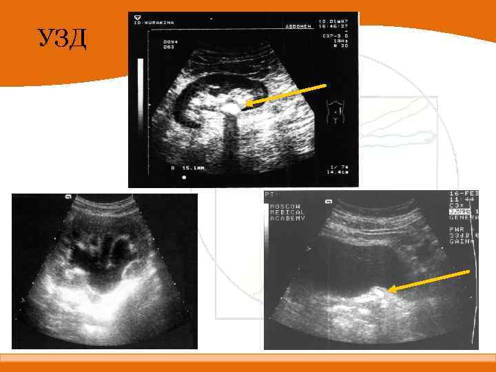 УЗД 