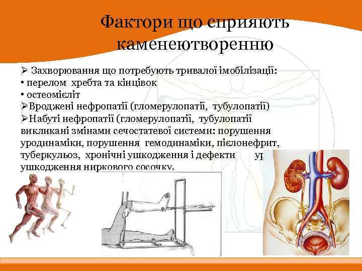 Фактори що сприяють каменеютворенню Ø Захворювання що потребують тривалої імобілізації: • перелом хребта та