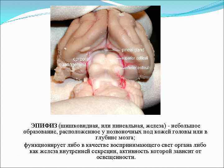 ЭПИФИЗ (шишковидная, или пинеальная, железа) - небольшое образование, расположенное у позвоночных под кожей головы