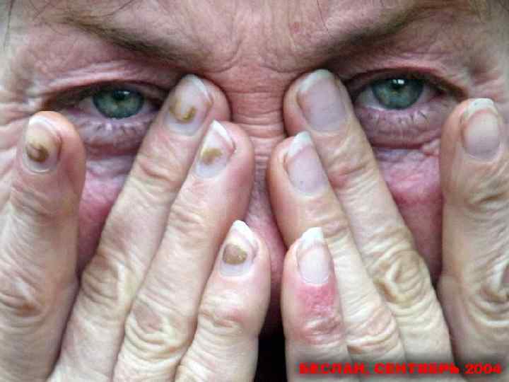 В сентябре 2014 года исполняется 10 лет со дня страшной трагедии в Беслане. Это