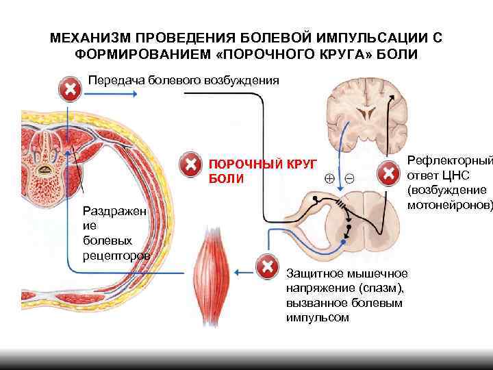 МЕХАНИЗМ ПРОВЕДЕНИЯ БОЛЕВОЙ ИМПУЛЬСАЦИИ С ФОРМИРОВАНИЕМ «ПОРОЧНОГО КРУГА» БОЛИ Передача болевого возбуждения ПОРОЧНЫЙ КРУГ