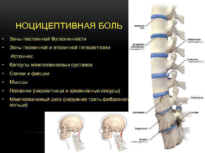 НОЦИЦЕПТИВНАЯ БОЛЬ • Зоны постоянной болезненности • Зоны первичной и вторичной гипералгезии Источник: •