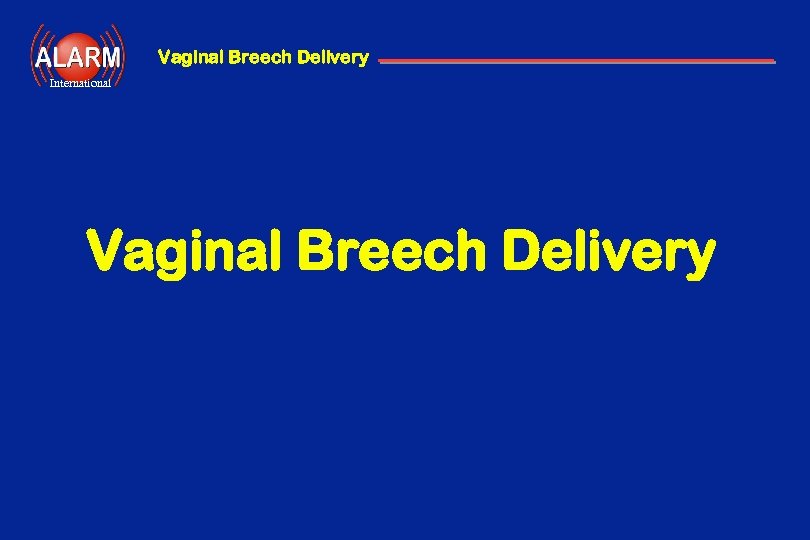 Vaginal Breech Delivery International Vaginal Breech Delivery 