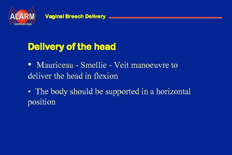 Vaginal Breech Delivery International Delivery of the head • Mauriceau - Smellie - Veit