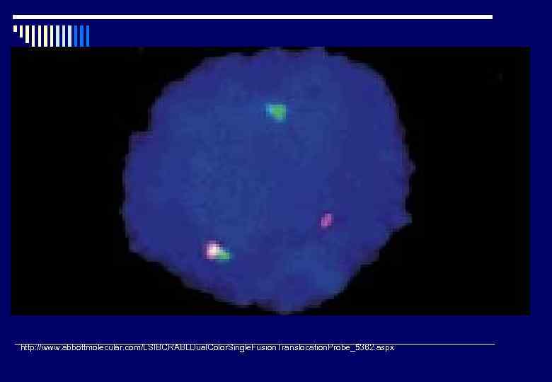 Fuzovaný gen bcr/abl u CML http: //www. abbottmolecular. com/LSIBCRABLDual. Color. Single. Fusion. Translocation. Probe_5362.