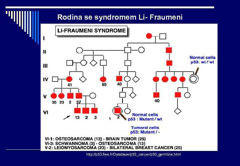 Rodina se syndromem Li- Fraumeni http: //p 53. free. fr/Database/p 53_cancer/p 53_germline. html 