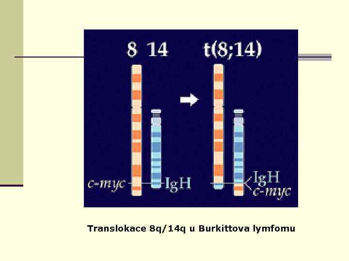 Translokace 8 q/14 q u Burkittova lymfomu 