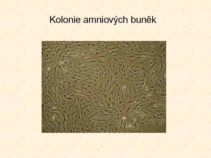 Kolonie amniových buněk 
