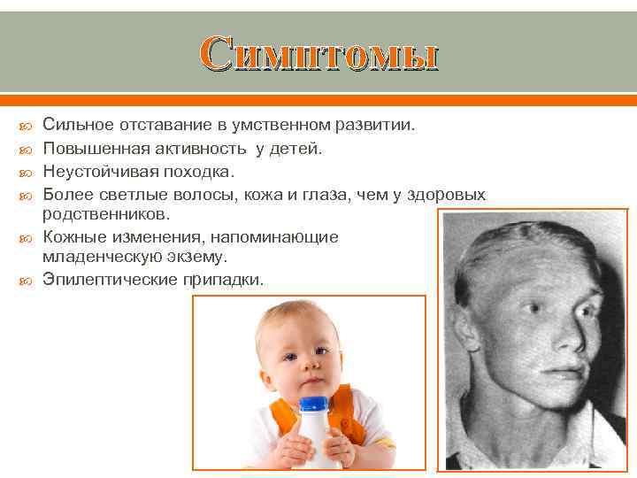 Симптомы Сильное отставание в умственном развитии. Повышенная активность у детей. Неустойчивая походка. Более светлые