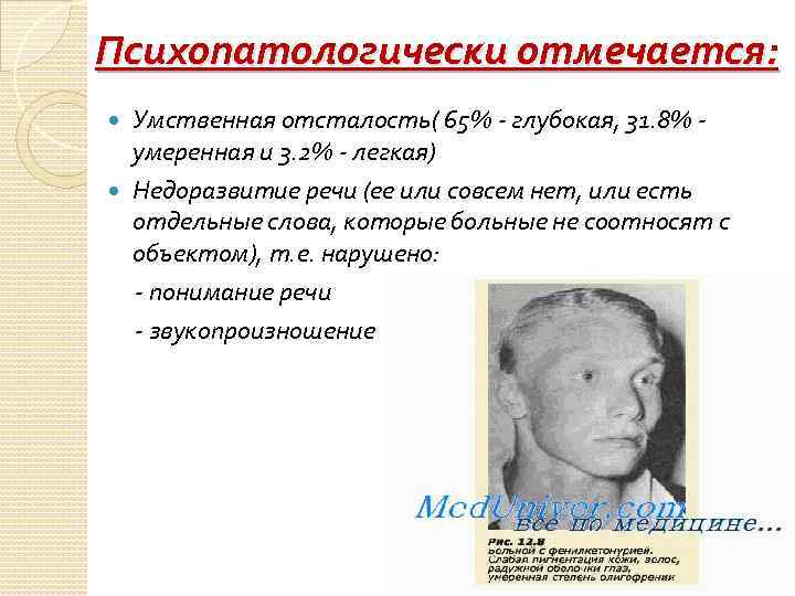 Психопатологически отмечается: Умственная отсталость( 65% - глубокая, 31. 8% умеренная и 3. 2% -