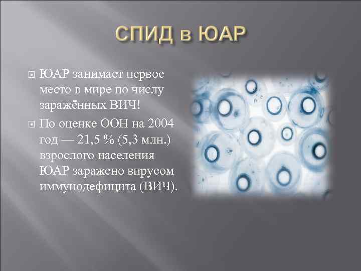  ЮАР занимает первое место в мире по числу заражённых ВИЧ! По оценке ООН