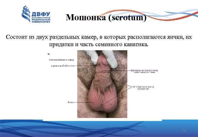 Мошонка (scrotum) Состоит из двух раздельных камер, в которых располагаются яички, их придатки и