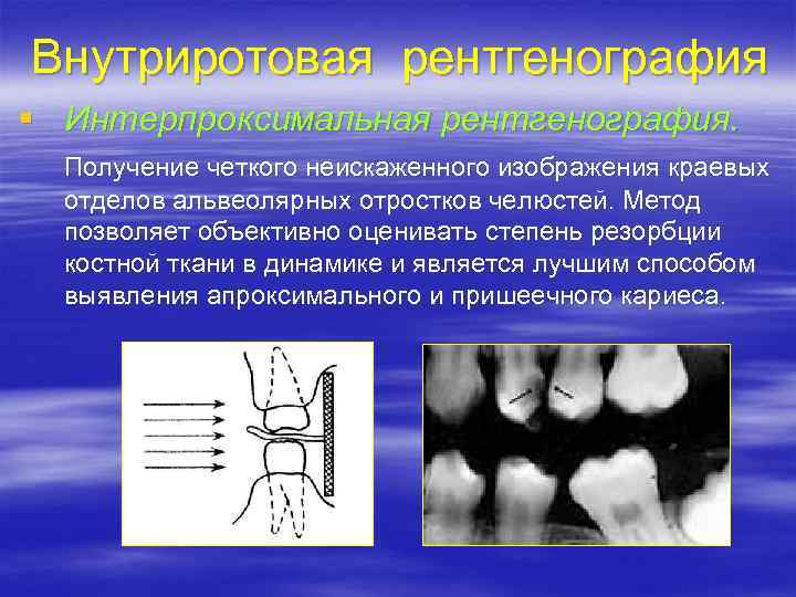 Интерпретация рентгеновского изображения является