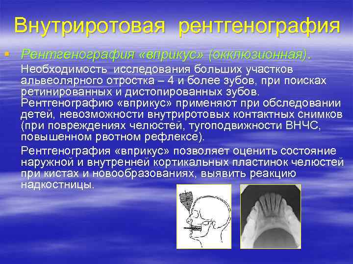 Это рентгенологическое исследование с регистрацией неподвижного изображения на специальной