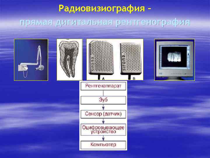 Радиовизиография – прямая дигитальная рентгенография 