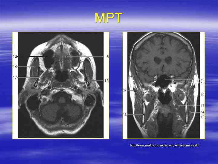 МРТ http: //www. medcyclopaedia. com, Amersham Health 
