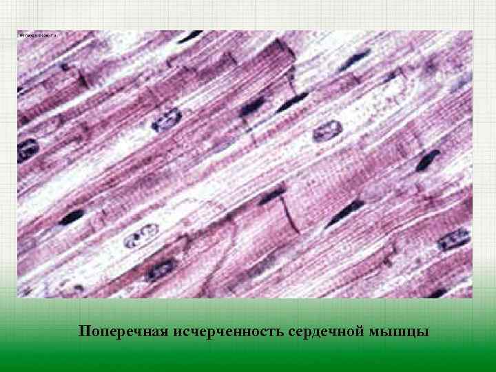 Поперечная исчерченность сердечной мышцы 