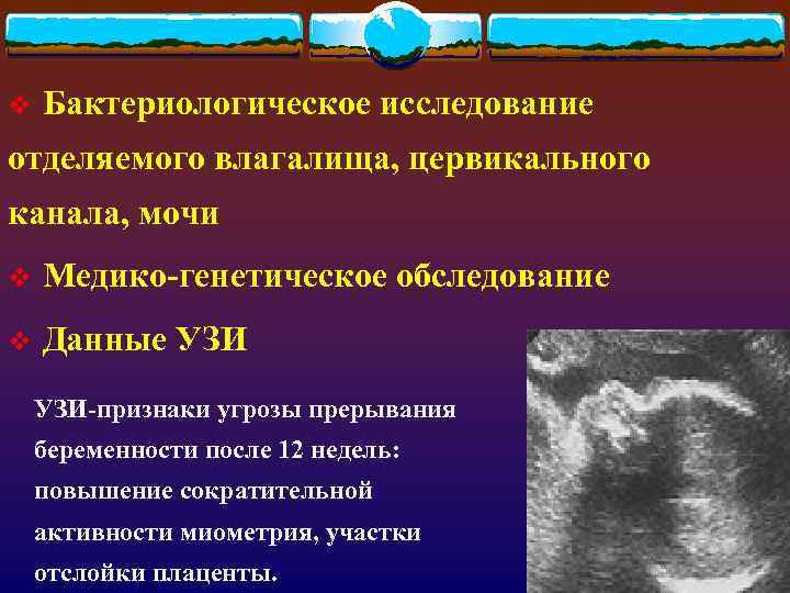 Роды узи. Отслойка плаценты УЗИ заключение. УЗИ признаки отслойки плаценты. Ультразвуковые признаки отслойки плаценты.