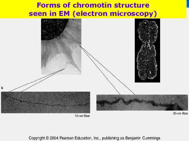 Forms of chromotin structure seen in EM (electron microscopy) 