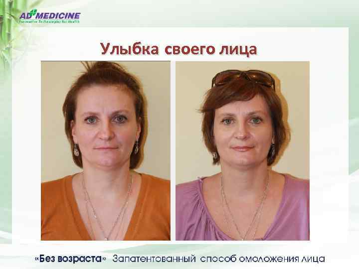 Улыбка своего лица 27 апреля 2013 27 июня 2013 