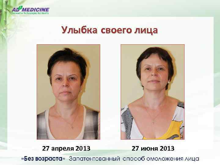 Улыбка своего лица 27 апреля 2013 27 июня 2013 