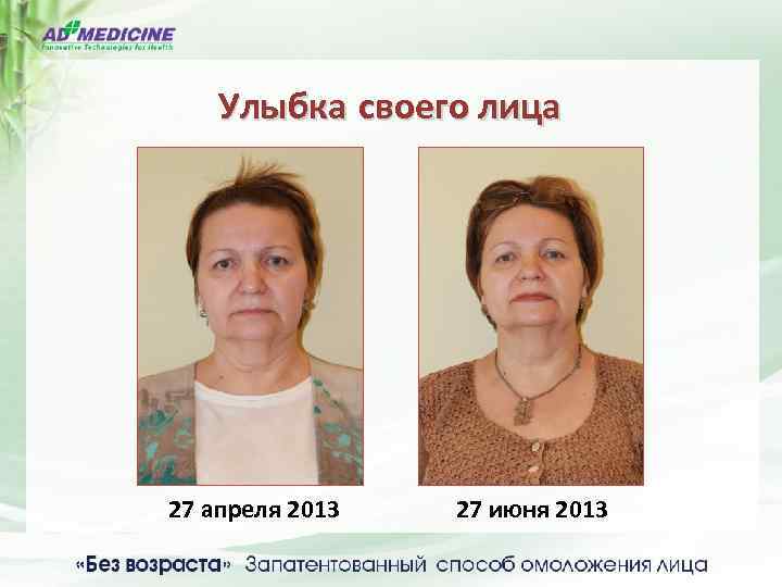 Улыбка своего лица 27 апреля 2013 27 июня 2013 