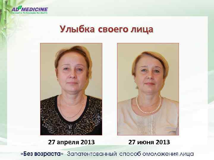 Улыбка своего лица 27 апреля 2013 27 июня 2013 