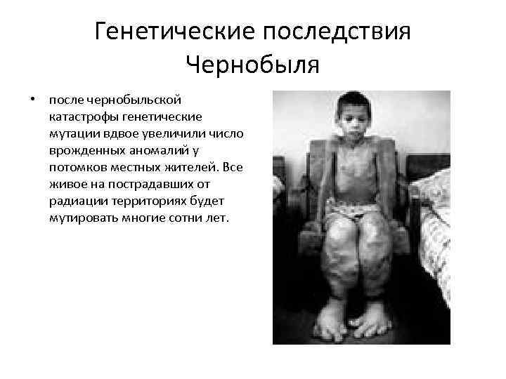 Генетические последствия Чернобыля • после чернобыльской катастрофы генетические мутации вдвое увеличили число врожденных аномалий