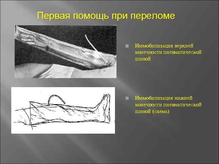 Презентация по травматологии