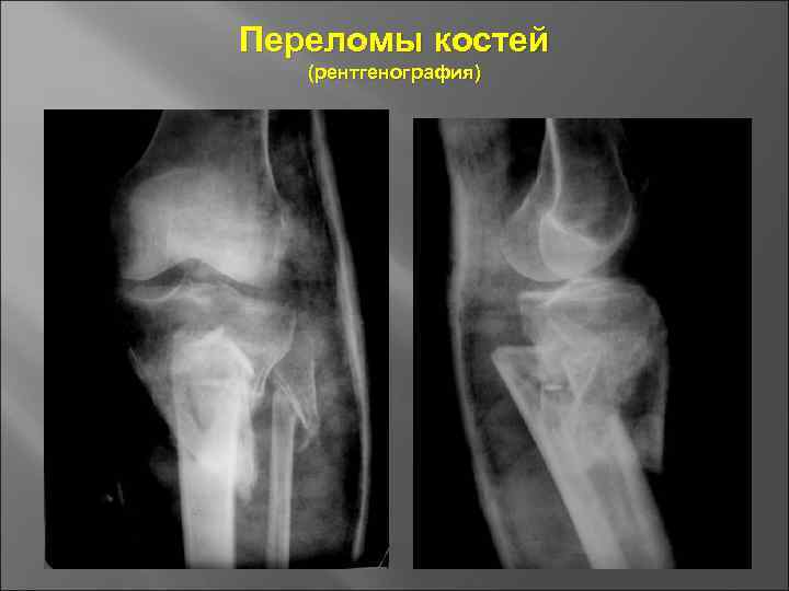 Основы травматологии презентация