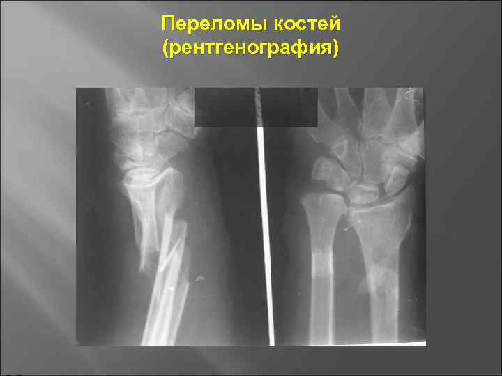 Основы травматологии презентация