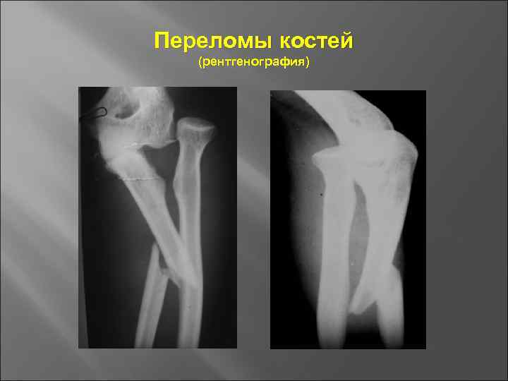 Основы травматологии презентация