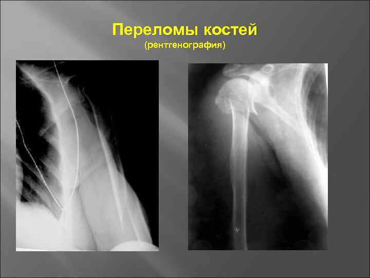 Основы травматологии презентация