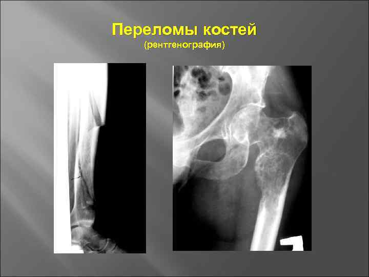 Основы травматологии презентация