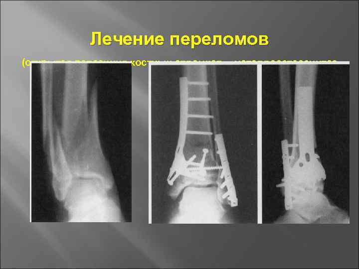 Основы травматологии презентация