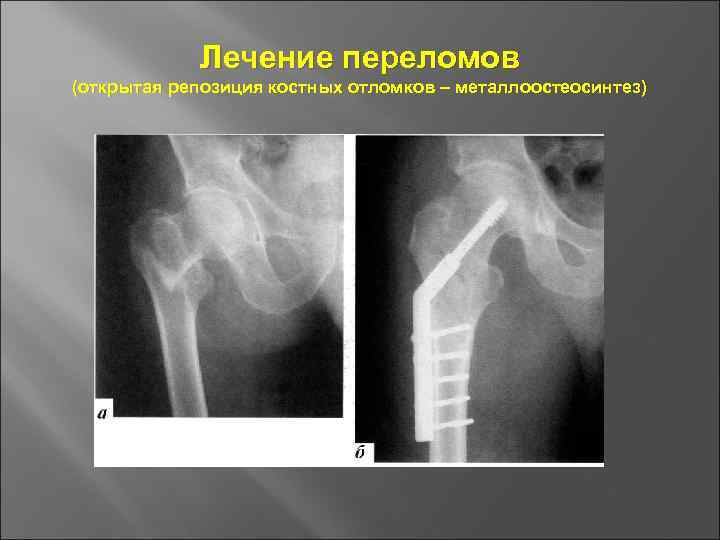 Основы травматологии презентация