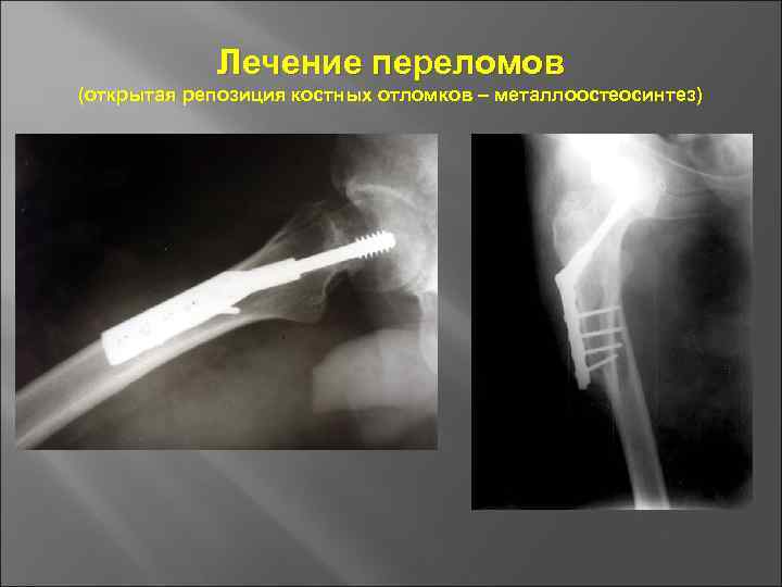 Основы травматологии презентация