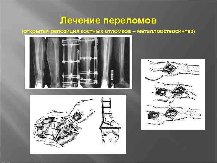 Презентация по травматологии